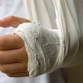 Arm Injury Compensation Solicitors in London